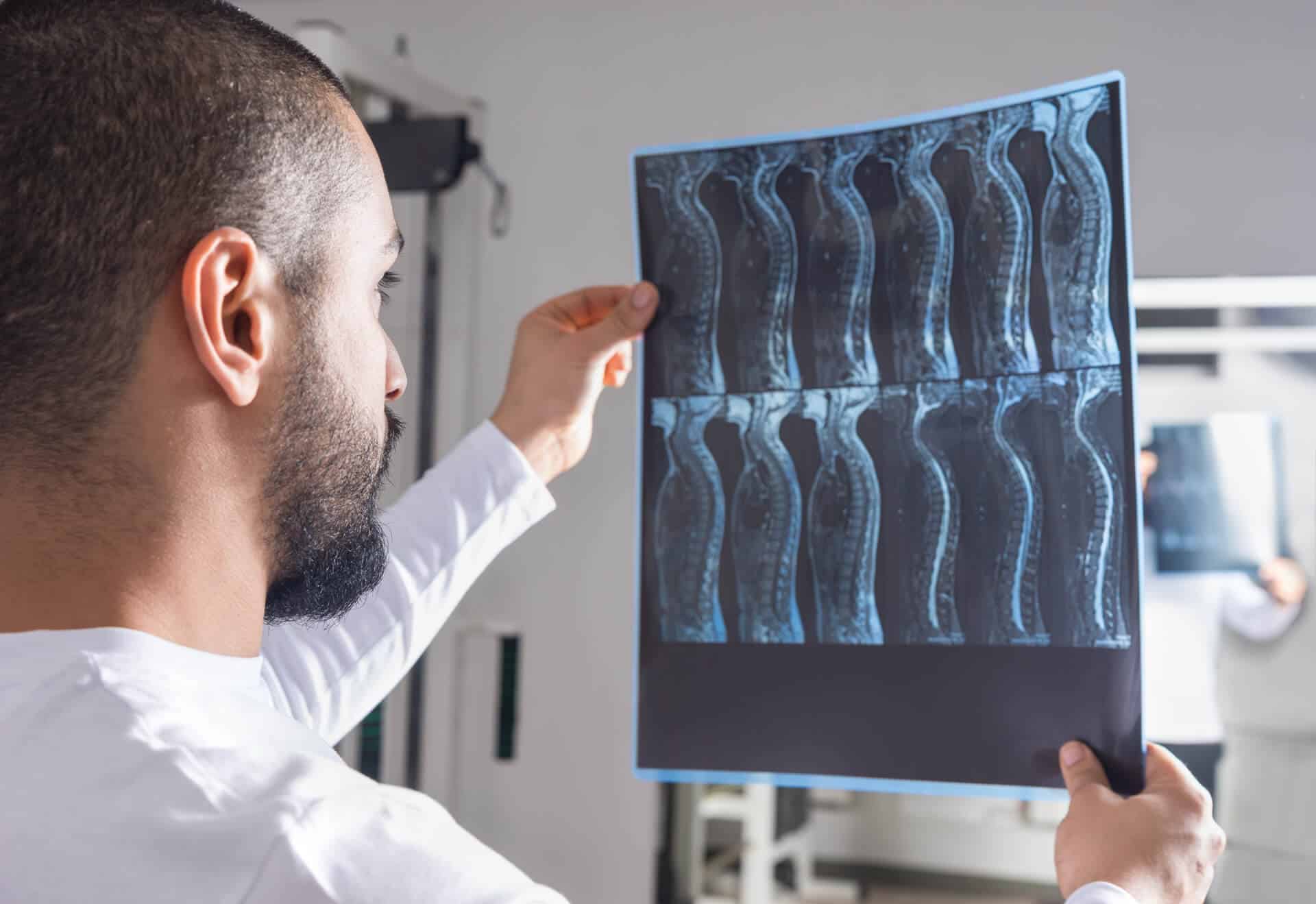 Spinal Cord X-Ray